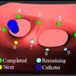 Pilot 4: Mapping and ablation of cardiac arrhythmias