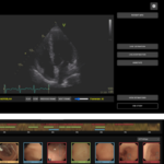 Pilot 1: Clinician-friendly, interpretable computer-aided diagnosis system to support and optimise clinical decision making